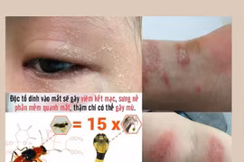 Kiến Ba Khoang - kẻ thù thầm lặng mùa mưa: Cách gì phòng tránh?