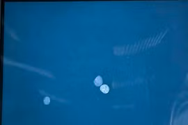 Chữa bệnh bằng thuốc cam, bé gái 9 tuổi nguy kịch vì ngộ độc chì nặng