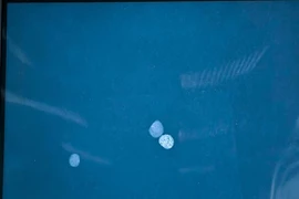 Chữa bệnh bằng thuốc cam, bé gái 9 tuổi nguy kịch vì ngộ độc chì nặng