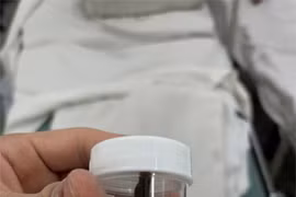 Bé gái 13 tuổi bị sinh vật lạ chui trong hốc mũi khi tắm suối