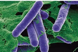 Hai trẻ nghi ngộ độc Botulinum toxin tại TP HCM cùng ăn chung tiệc tất niên 