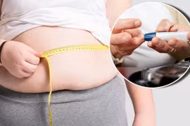 Béo phì dẫn đến đái tháo đường Type 2 ở người trẻ