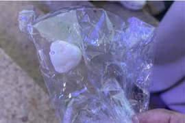 Hy hữu: Đang chăm cây, cụ ông bị sỏi rơi vào miệng gây suy hô hấp