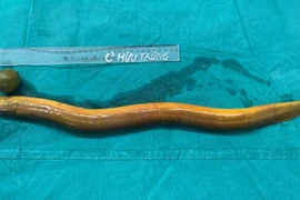  Thanh niên 31 tuổi suýt "mất mạng" vì nhét con lươn 65cm vào hậu môn