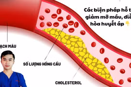 Cẩn thận tăng chỉ số mỡ máu cholesterol vào mùa đông gây đột quỵ