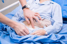 Chủ quan sùi hậu môn không khám, bệnh nhân phải làm hậu môn nhân tạo 