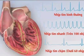 Nhịp tim chậm có nguy hiểm?
