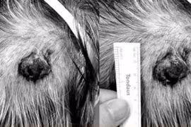 Tuyến mồ hôi cũng có thể ung thư và di căn