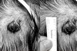 Tuyến mồ hôi cũng có thể ung thư và di căn