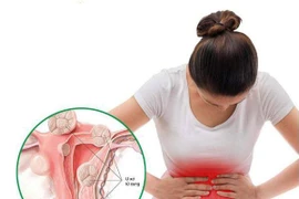 Bác sĩ chỉ rõ 12 đối tượng cần đi khám sàng lọc định kỳ ung thư