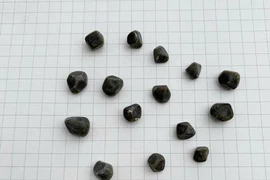 Nội soi lấy 15 viên sỏi trong túi mật người phụ nữ 37 tuổi