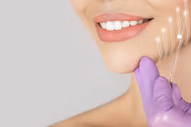 Cách cấy chỉ làm đẹp an toàn, không gây biến chứng