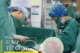 “Mất” tử cung vì chủ quan để u 10 năm mới đi khám