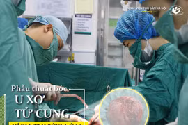 “Mất” tử cung vì chủ quan để u 10 năm mới đi khám