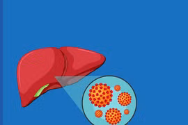 Men gan cao có cần uống thuốc?