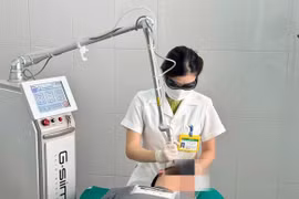 Laser CO2 điều trị dày sừng da dầu, các nốt nâu, đen trên mặt