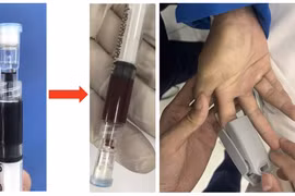 Kịp thời chia sẻ thuốc hiếm cứu sống 2 bệnh nhân bị ngộ độc hóa chất nặng