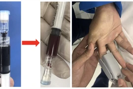 Kịp thời chia sẻ thuốc hiếm cứu sống 2 bệnh nhân bị ngộ độc hóa chất nặng