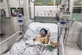 Trẻ 10 tuổi bị bò dẫm đạp đa chấn thương, dập rách phổi, nách