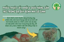 Trẻ 1 tháng tuổi có u quái nặng gần 1 kg trong dạ dày