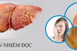 Thải độc gan sai cách… coi chừng hại cơ thể