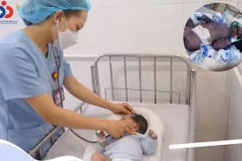 Cứu sống trẻ 22 ngày tuổi nguy kịch do bị thủy đậu toàn thân
