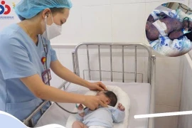 Cứu sống trẻ 22 ngày tuổi nguy kịch do bị thủy đậu toàn thân