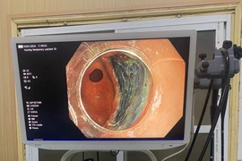 Cắt tách niêm mạc: kỹ thuật hàng đầu thế giới chữa ung thư đường tiêu hóa