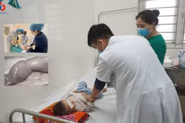 Nhiều trẻ đang chơi đùa đột ngột mắc bệnh lồng ruột