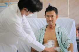 Xơ teo gan do sỏi lấp đầy đường mật trong gan 13 năm