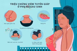Viêm tuyến giáp sau sinh dễ nhiễm độc, suy giáp