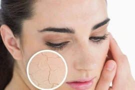 Làm thế nào để duy trì độ ẩm cho da trong mùa đông?