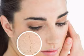 Trẻ hoá làn da cho khuôn mặt xinh đẹp