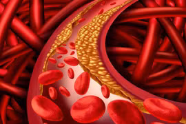 Chỉnh thói quen buổi sáng giúp giảm mỡ máu, nhất là chỉ số cholesterol