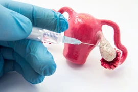 Bác sĩ chỉ rõ cách ăn uống, sinh hoạt sau khi tiêm kích trứng