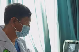 Lấy kim tây hơn 3 cm trong thực quản bé trai 10 tháng tuổi