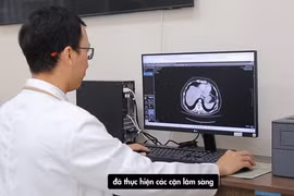 Đột nhiên đi tiểu ra máu, vào viện phải cắt thận do u xâm lấn