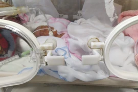 Điều trị thành công sơ sinh cực non tháng mới 27 tuần 