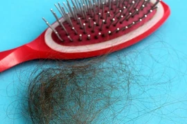 Rụng tóc do bệnh tuyến giáp?