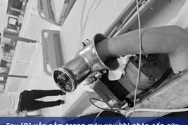 Đưa cả bàn tay trong máy xay thịt đi cấp cứu