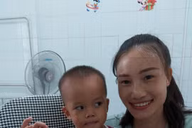 Tạo hình thành công ngón tay cái cho bệnh nhi Lào bị di chứng bỏng nặng nề