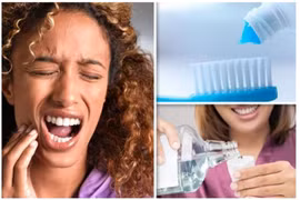 Bệnh răng tê buốt do nhạy cảm ngà răng