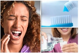 Bệnh răng tê buốt do nhạy cảm ngà răng