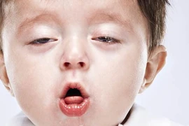 Bé trai 1 tháng tuổi viêm phổi nặng vì ho gà: Cách gì phòng tránh?