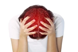 Bác sĩ cảnh báo kiểu đau đầu mạng mỏng như giấy