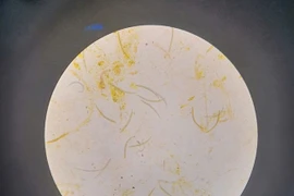 Giun lươn: bệnh truyền nhiễm nguy hiểm nhiều người mắc nhưng bị lãng quên