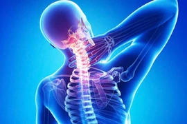  Thực phẩm chức năng hỗ trợ điều trị thoái hóa đốt sống cổ