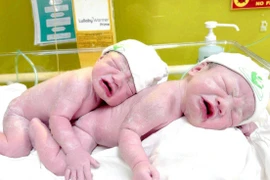 Cặp song sinh siêu nghịch: Một dây rốn thắt nút, một 3 vòng rau quấn cổ