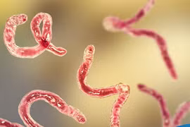 7 lời khuyên từ bác sĩ để phòng tránh nhiễm ký sinh trùng