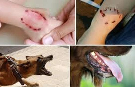 Người đàn ông lên cơn dại, tử vong sau 2 năm bị chó cắn